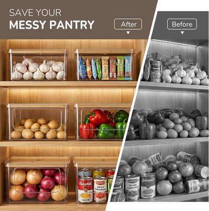 Hudgan Potato and Onion Storage Bin for Pantry Organizer, Veggie Container